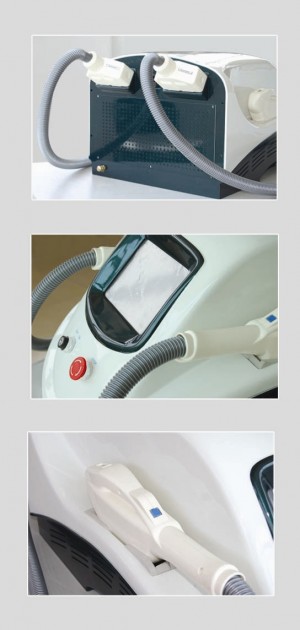 belinda oficios y profesiones en Alto Hospicio |  IPL rejuvenecimiento de la piel de la m&aacute;quina, IPL rejuvenecimiento de la piel de la m&aacute;quina