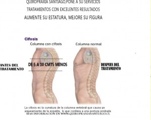 carlos oficios y profesiones en Santiago |  aumente su estatura, quiropraxia en santiago